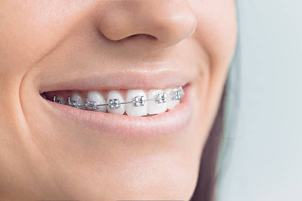 Why Choose Us for Your Dental Needs in Mill Neck, NY